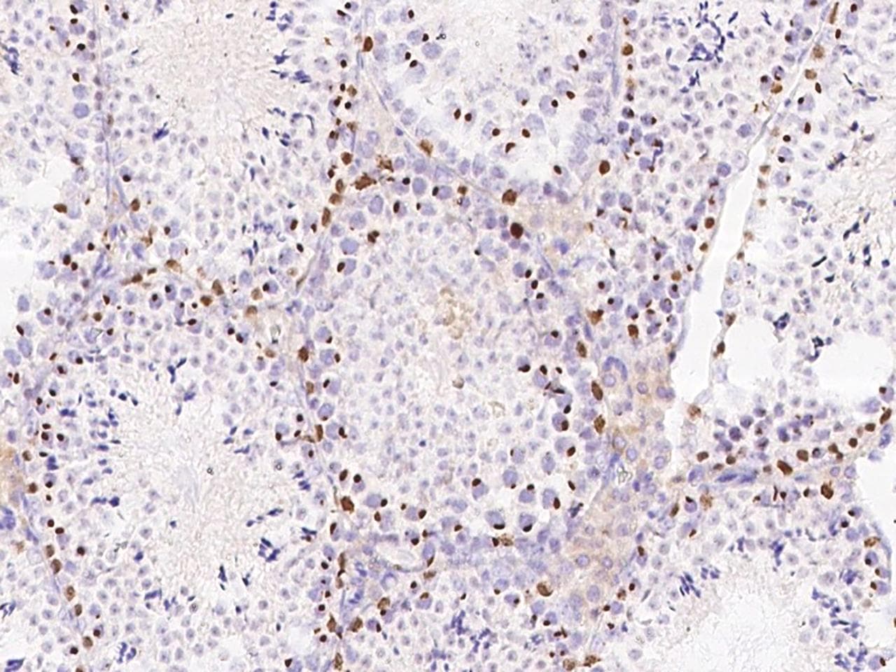 SALL4 Antibody (Preservative Free)