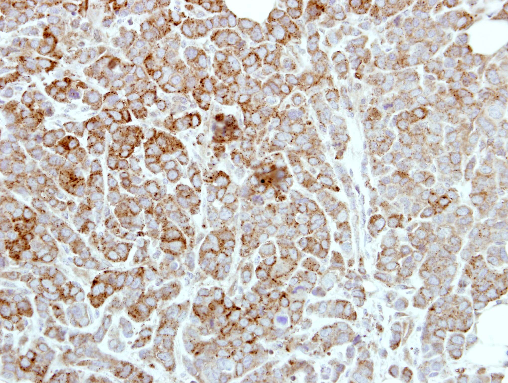 Polyclonal Rabbit anti-Human PDE1A Antibody (aa212-535, IHC, WB)
