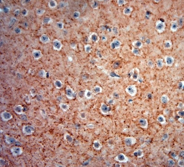 GAD 65+67 Antibody (aa530-600)