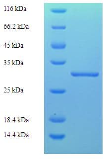Rat KLK7 / Kallikrein 7 Protein (Recombinant His)