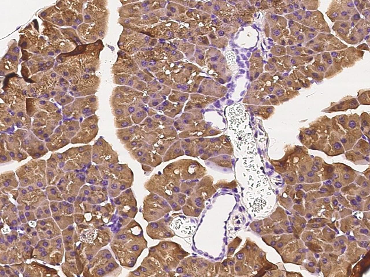 NME1 / NM23 Antibody (Preservative Free)