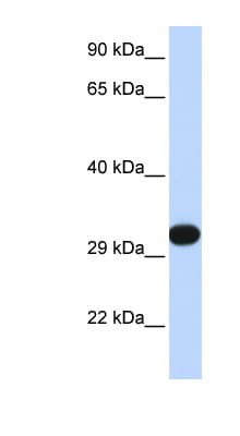 PDGF-BB Antibody (N-Terminus, HRP)