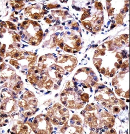 POLI Antibody (aa673-701)