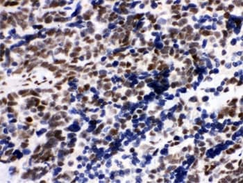 XRCC5 / Ku80 Antibody