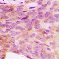 Polyclonal Rabbit anti-Human NDUFV3 Antibody (Internal, IHC, WB)