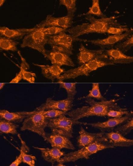 UBQLNL Antibody