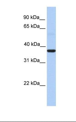 Polyclonal Rabbit anti-Human LEREPO4 / ZC3H15 Antibody (aa290-339, IHC, WB)
