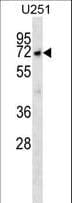 MKKS Antibody (aa408-437)