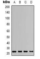 Polyclonal Rabbit anti-Human PYCARD / ASC / TMS1 Antibody (N-Terminus, IHC, IF, WB)