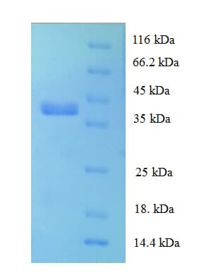 Human RPL28 / Ribosomal Protein L28 (Recombinant GST)