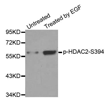 HDAC2 Antibody (phospho-Ser394)