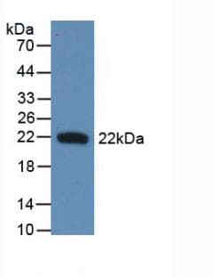 IFN Beta / Interferon Beta Antibody (Biotin)