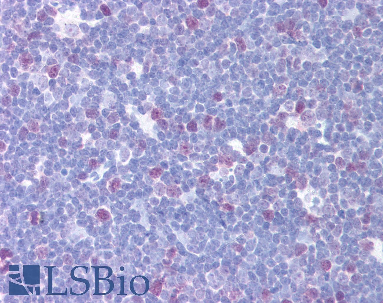 IHC-plus™ Polyclonal Rabbit anti-Human CENPF / CENP-F Antibody (C-Terminus, IHC, IF, WB)