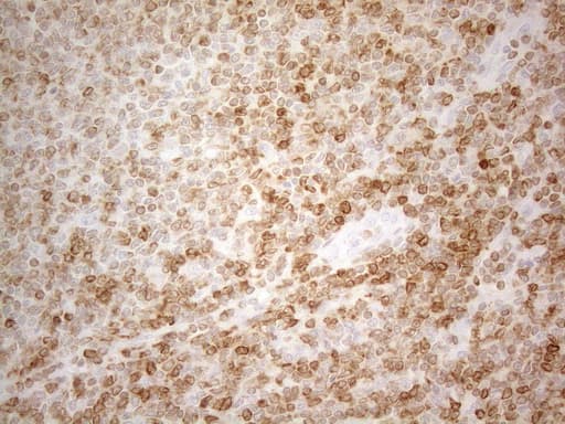 BCL2 / Bcl-2 Antibody (clone UMAB225)