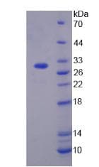 Human TGFBI Protein (Recombinant His-T7)