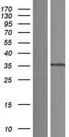ELP5 Protein (Over-Expression Lysate Myc-DDK (Flag))