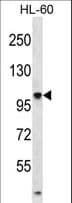 Polyclonal Rabbit anti-Human TTLL4 Antibody (aa464-493, WB)