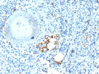 Recombinant Monoclonal Rabbit anti-Human ACP5 / TRAP Antibody (clone ACP5/2336R, IHC)