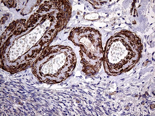 TYW2 / TRMT12 Antibody (clone 5C9)