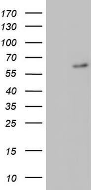 RORA / ROR Alpha Antibody (aa98-345, clone OTI2E8)