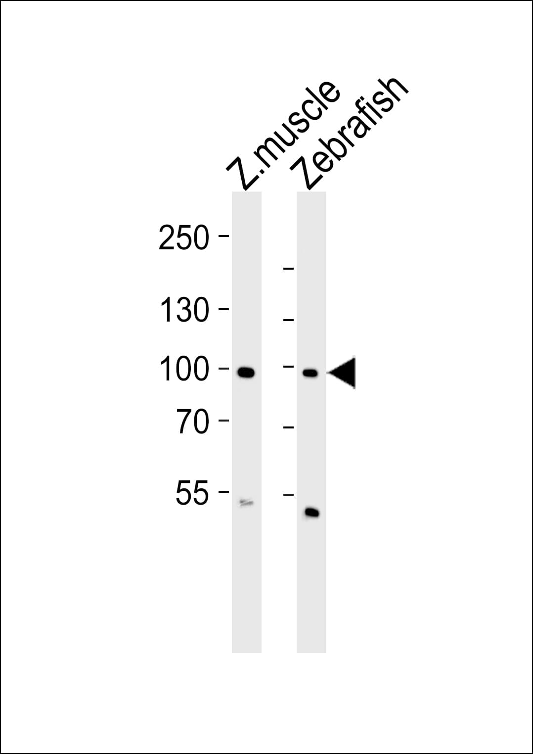 ZNF148 / ZBP-89 Antibody (aa287-320)