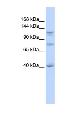 DHX30 Antibody (N-Terminus)