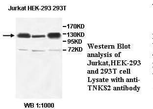TANK2 / TNKS2 Antibody
