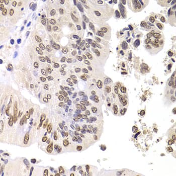 Polyclonal Rabbit anti-Human SOX5 Antibody (aa1-120, IHC, IF, WB)