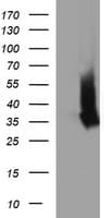 EPCAM Antibody (clone OTI2B4)