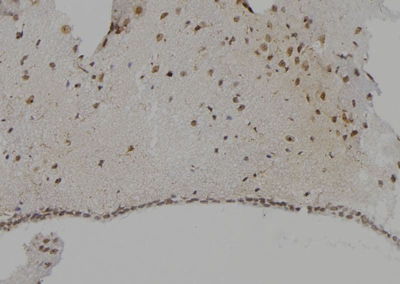 Polyclonal Rabbit anti-Human CTSG / Cathepsin G Antibody (IHC, IF, WB)