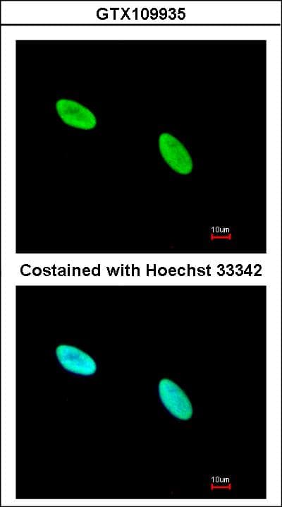 XRCC5 / Ku80 Antibody (aa315-593)