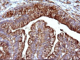 SCAMP2 Antibody (clone OTI3C2)