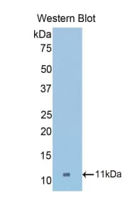 COL2A1 / Collagen II Alpha 1 Antibody (aa1307-1383)