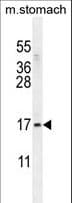 Polyclonal Rabbit anti-Human ZNF428 Antibody (aa42-70, WB)