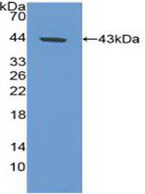 CA9 / Carbonic Anhydrase IX Antibody (aa59-414)
