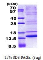 Human NMB / Neuromedin B Protein (Recombinant His)