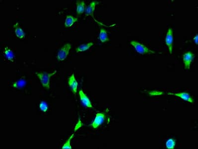 GPCR6 / GPR101 Antibody