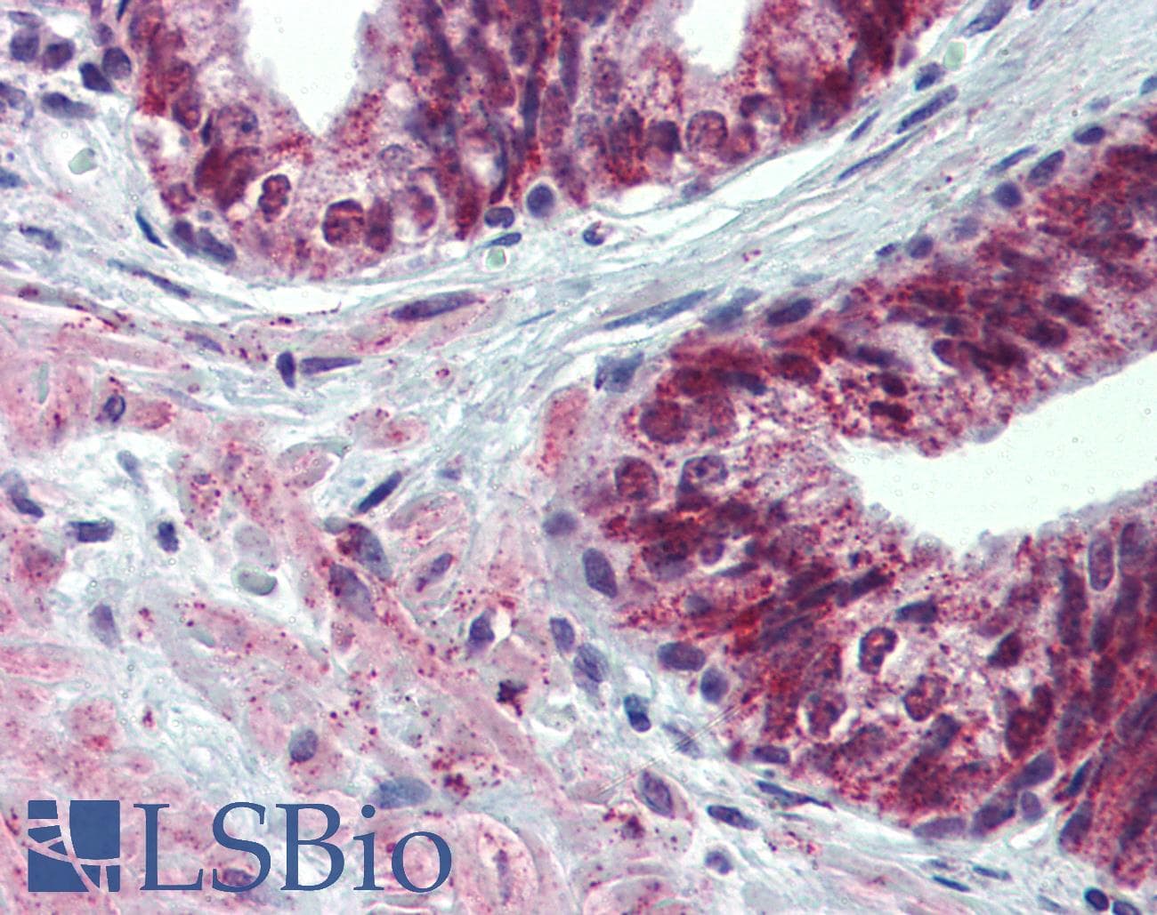 PathPlus™ Polyclonal Rabbit anti-Human ACVR2 / ACVR2A Antibody (IHC, WB)