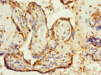 ZP2 Antibody