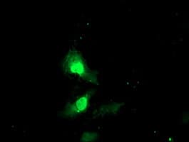 EXOSC7 Antibody (clone OTI1G8)