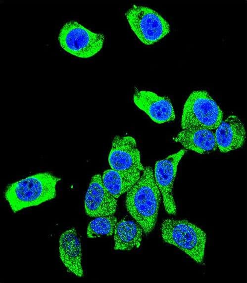 Polyclonal Rabbit anti-Human PARK7 / DJ-1 Antibody (aa1-30, IF, WB)