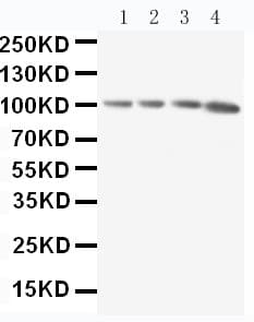 APBB1IP / RIAM Antibody (aa647-666)