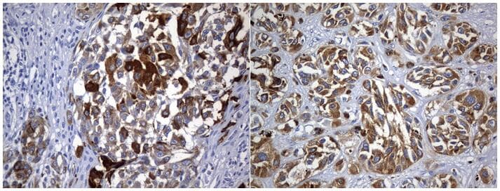 Tyrosinase Antibody (aa19-320, clone UMAB257)