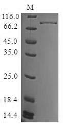 Human BTK Protein (Recombinant 10His, N-terminus)