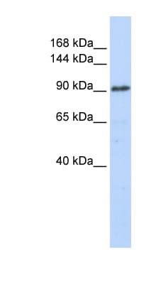 Polyclonal Rabbit anti-Human GTF3C3 Antibody (aa36-85, WB)