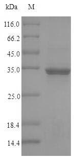 Human CCDC3 Protein (Recombinant 10His, N-terminus + Myc, C-terminus)