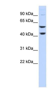 Polyclonal Rabbit anti-Human ATP6V1B2 Antibody (C-Terminus, WB)