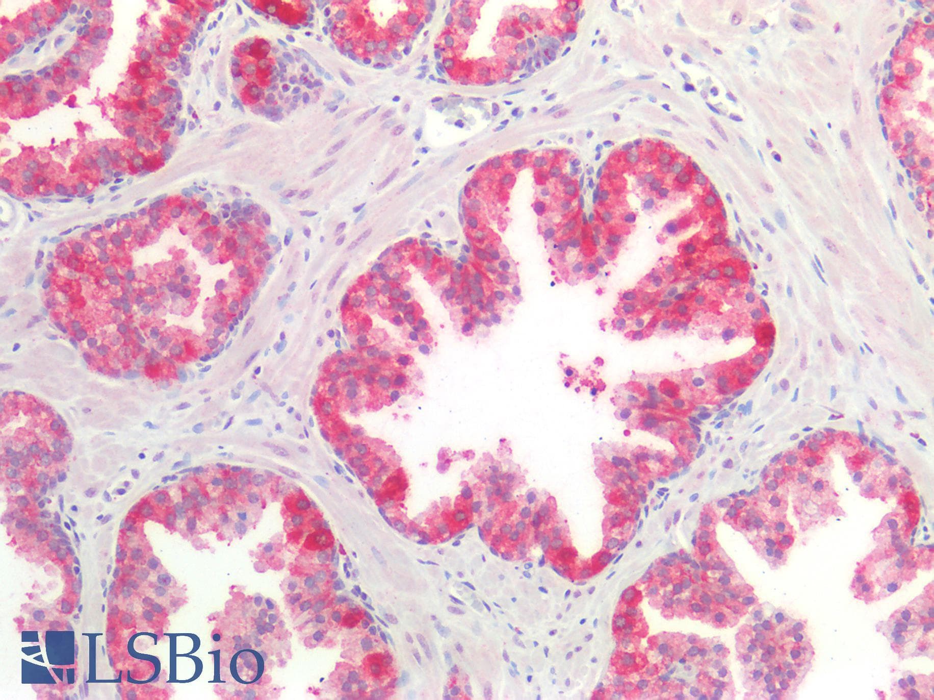 IHC-plus™ Polyclonal Rabbit anti-Human VEGFA / VEGF Antibody (IHC)