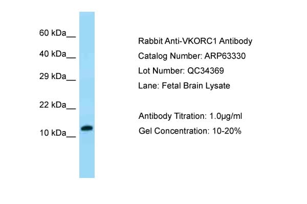 Polyclonal Rabbit anti-Human VKORC1 Antibody (aa27-76, IHC, WB)
