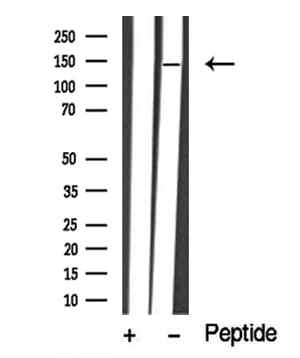 Polyclonal Rabbit anti-Human ABL1 / c-ABL Antibody (WB)